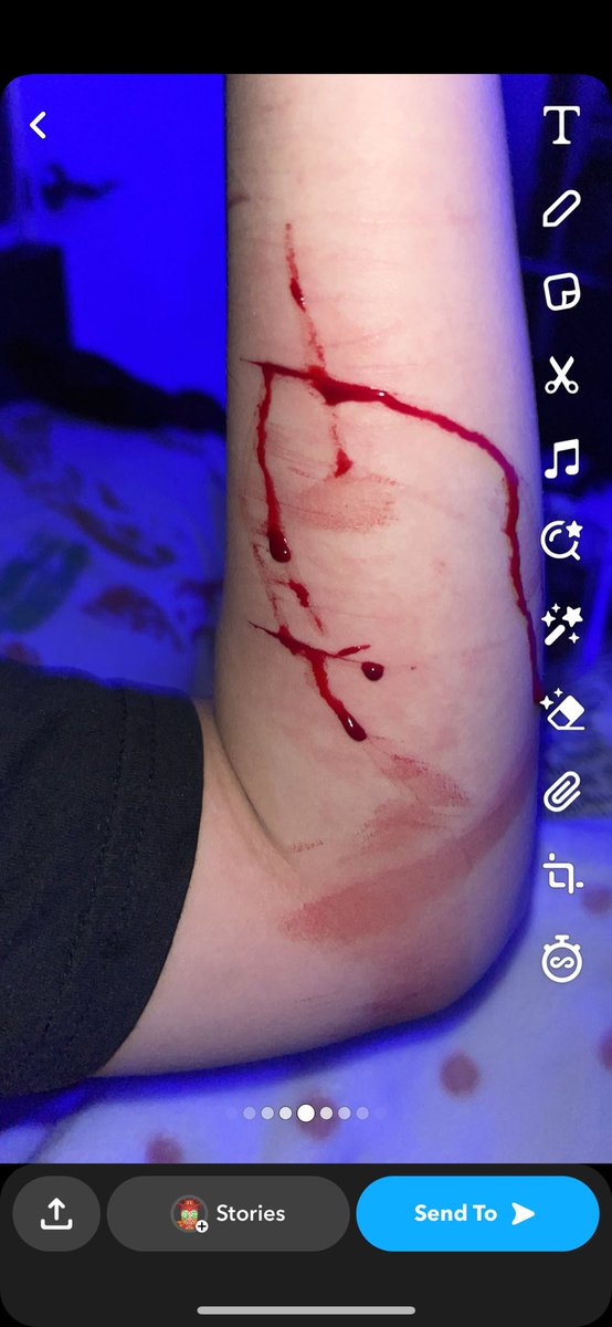 jbxyss0's tweet photo. just relapsed guys 😣 https://t.co/l63O39Ins4