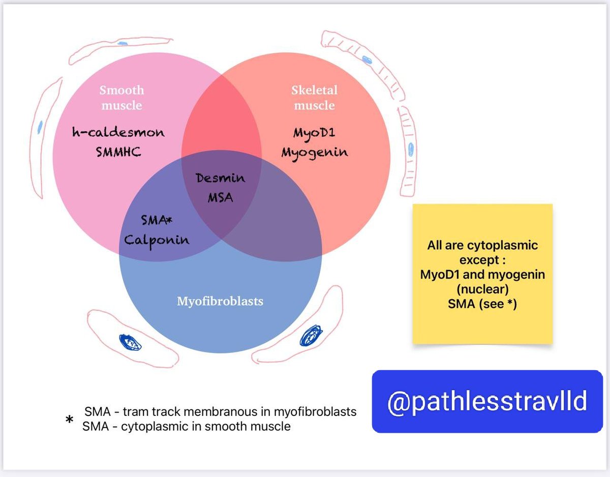 I always thought #IHCPath would be so much simpler with the help of Venn Diagrams

#bstpath #pathology #pathX #pathtwitter
