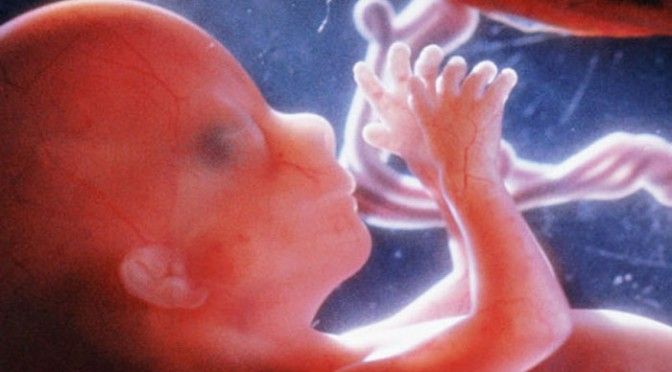 Medical Expert Confirms Unborn Children Feel Excruciating Pain During Abortions buff.ly/2Bj7RRQ