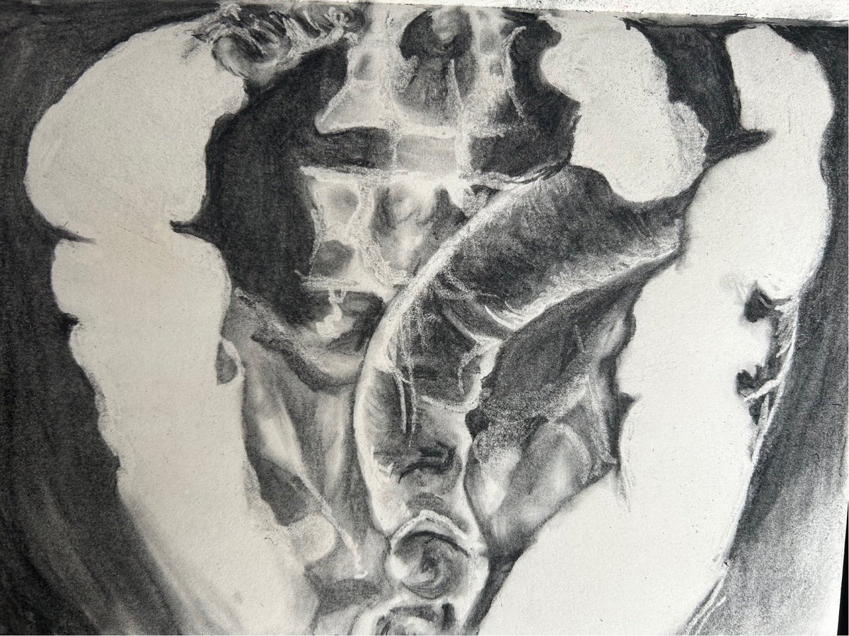 Charcoal isnt my favourite but created these #CTSCAN sketches is both #ulcerativecolitis and #crohnsdisease today and  create the silhouettes of the scans well #art #drawing #sketch