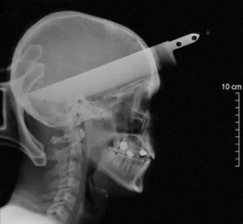 mitsuoxp's tweet photo. mi próximo piercing https://t.co/CvPAsRBAE8