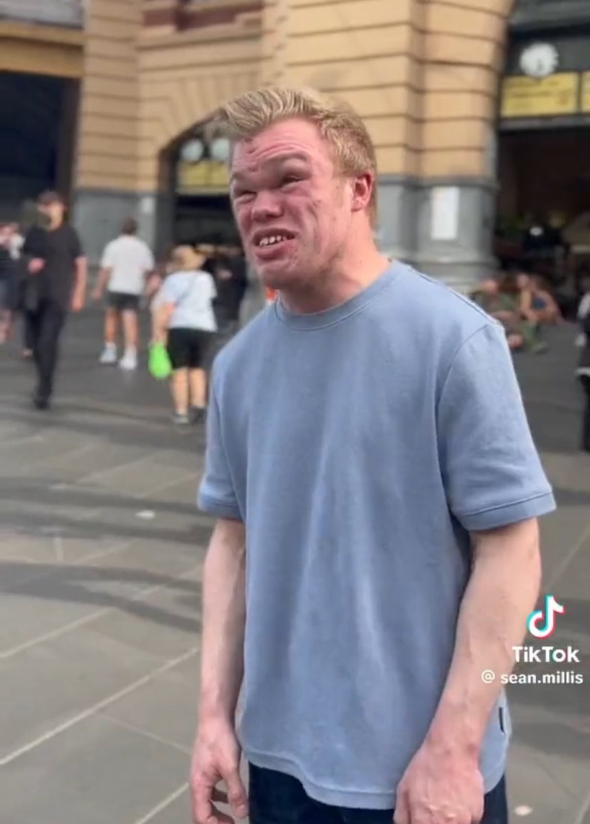 When you’re 12 pints deep tryna read the menu in the kebab house