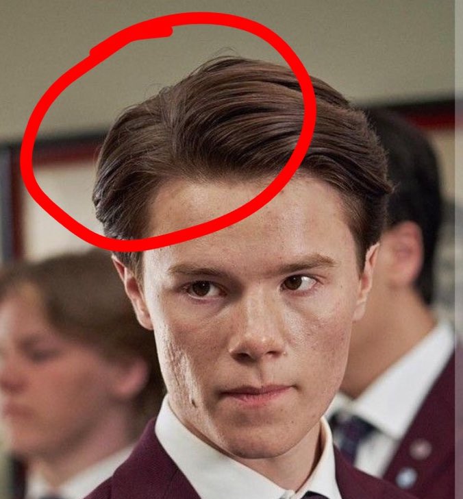 jagalskardigsss's tweet image. How did he move where his hair was growing from