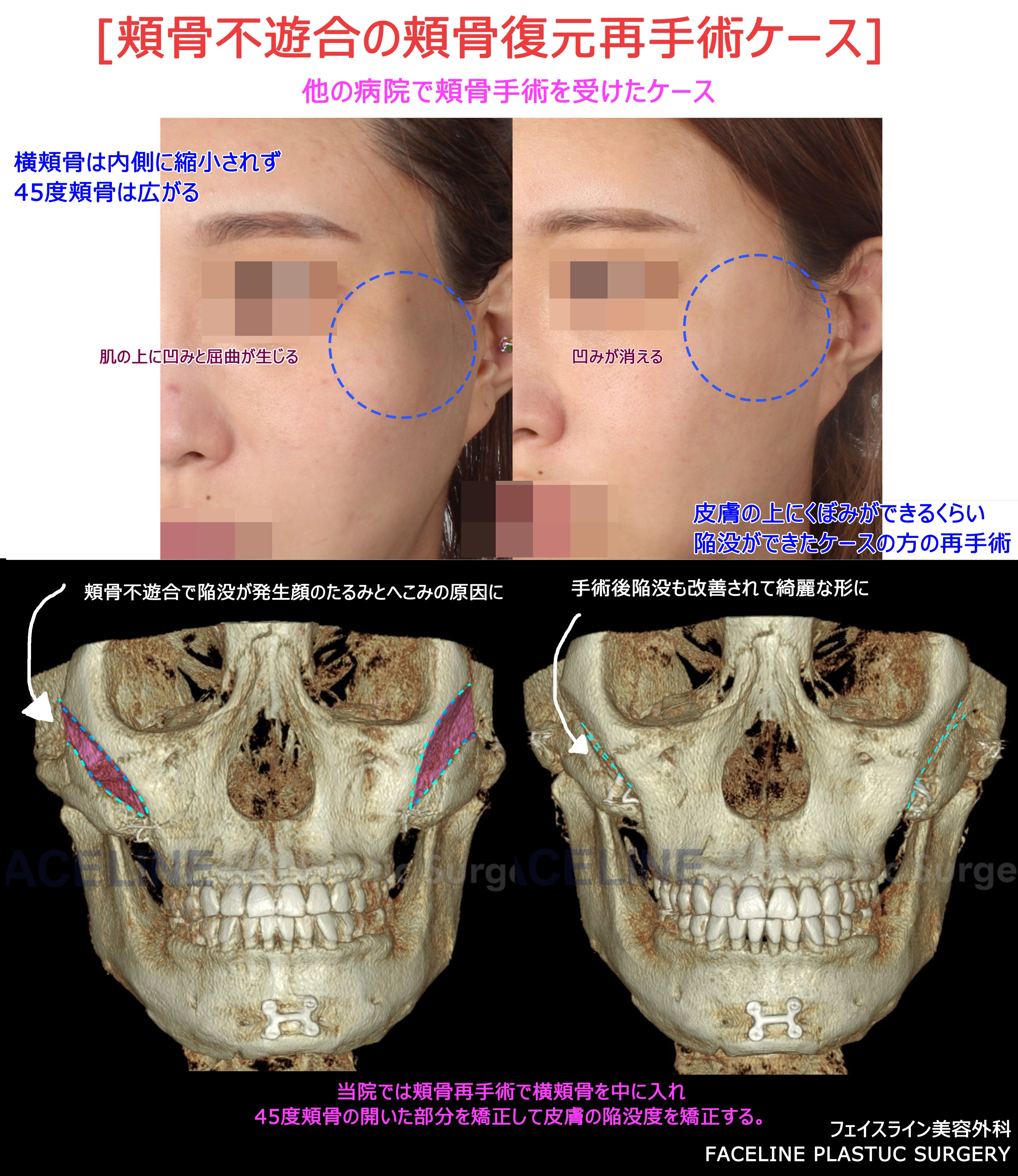 顔の美容外科手術 顔の美容外科手術 顔の美容外科手術 ZX-CLINIC【公式】｜大阪梅田・