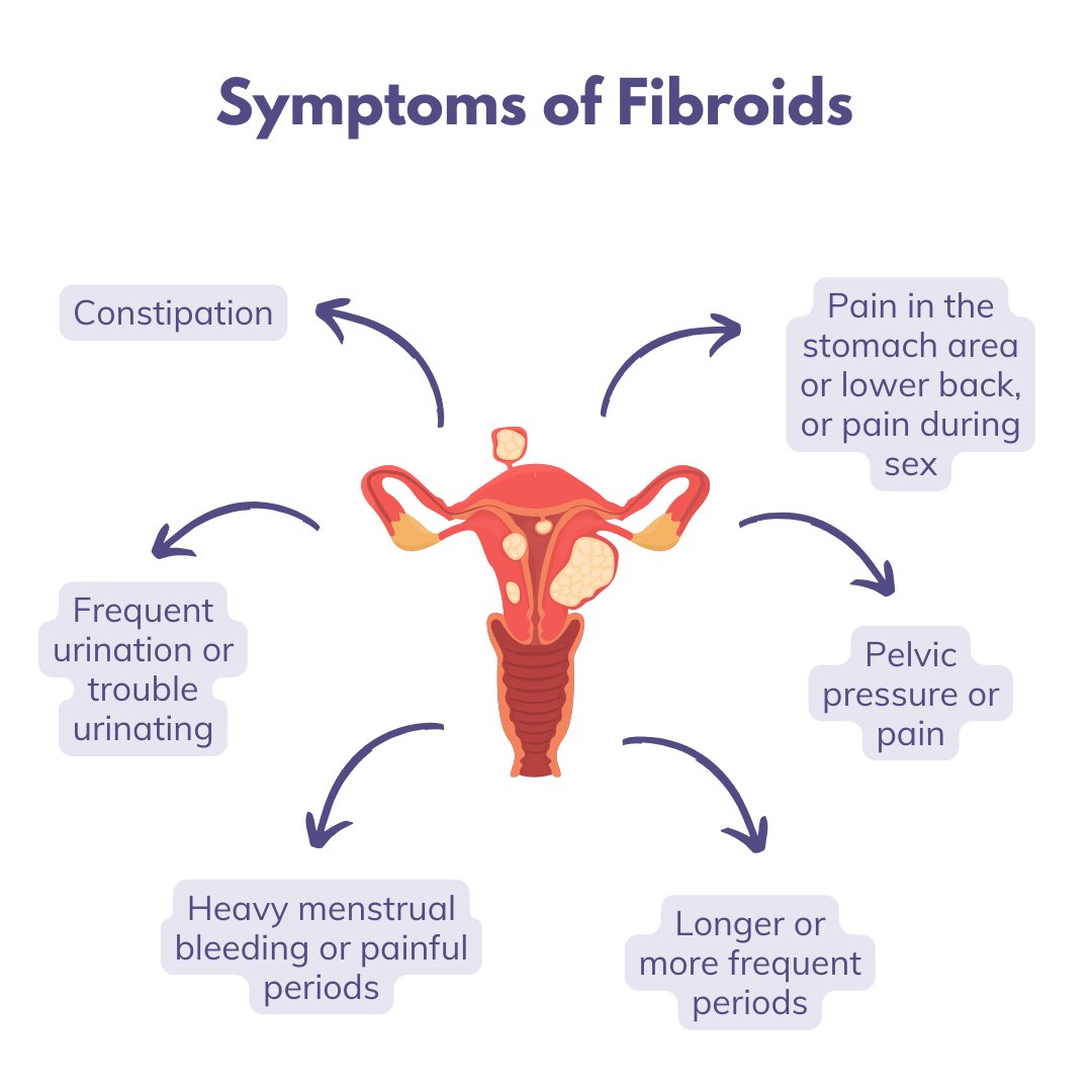 Could you be recognizing the signs of fibroids? From heavy periods to pelvic pain, these symptoms might be indicators. Awareness is key! #FibroidSymptoms #WomensHealth #KnowYourBody #FibroidAwareness Safety info: bit.ly/2LFfyHh