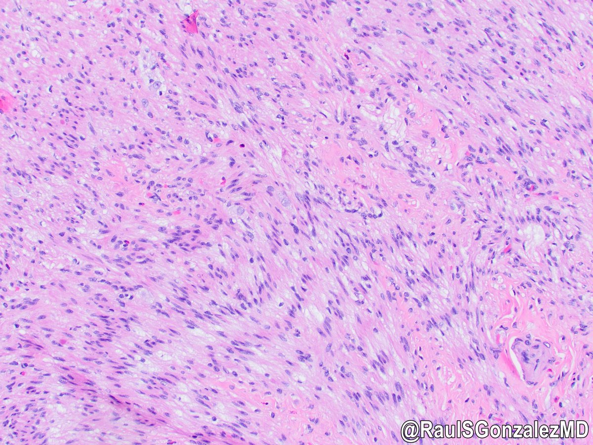 Raul S. Gonzalez, MD tweet media