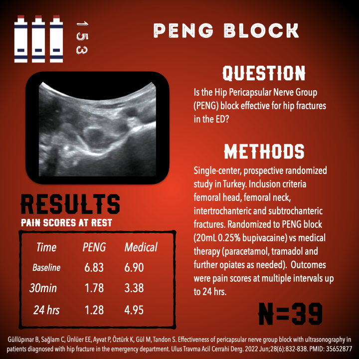US GEL PODCAST #153! PENG Block - for Hip Fractures #POCUS #USGEL #FOAMed ultrasoundgel.org/153