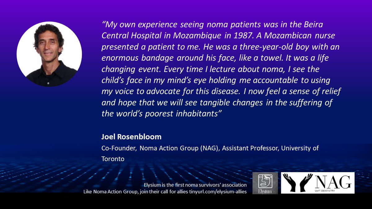 ISNTD (@isntd_press) on Twitter photo Partnerships with champions of global #oralhealth are key to the prevention of #noma: Dr Joel Rosenbloom of the <a href="/UofTDentistry/">U of T Dentistry</a> and Noma Action Group reflects upon what <a href="/WHO/">World Health Organization (WHO)</a>'s recognition of #noma as a NTD means for affected persons nomaactiongroup.com Partnerships with champions of global #oralhealth are key to the prevention of #noma: Dr Joel Rosenbloom of the <a href="/UofTDentistry/">U of T Dentistry</a> and Noma Action Group reflects upon what <a href="/WHO/">World Health Organization (WHO)</a>'s recognition of #noma as a NTD means for affected persons nomaactiongroup.com