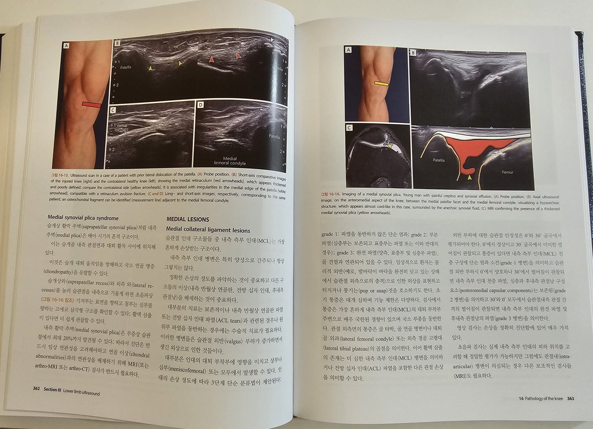 이 책이 한국어로 번역된 것은 영광입니다.  매우 감사합니다.
#ultrasound of the Musculoskeletal system <a href="/MskRoom1/">Msk room</a>
