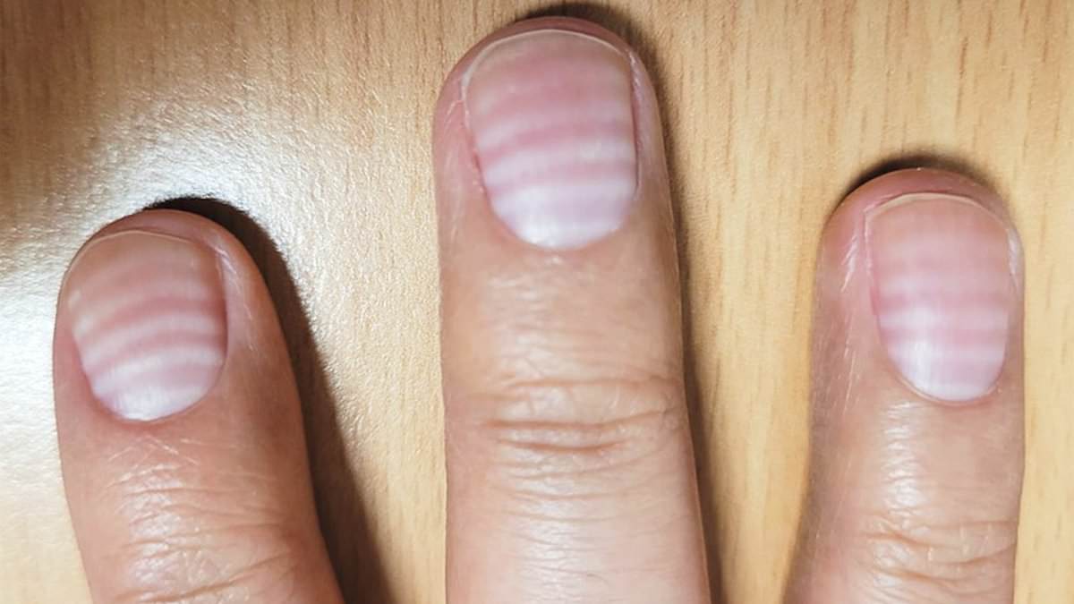 If You Have Ridges On Your Fingernails It Means This - YouTube