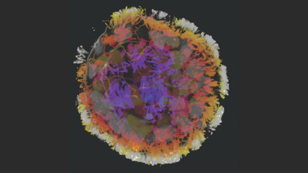 andresvilarino's tweet image. #Scientists Develop Self-Assembling #BiologicalRobots That Help Heal Wounds

#microscopic #Robots #Robotics #Innovation #Tech #Technology #medicalResearch

buff.ly/41uV8HA