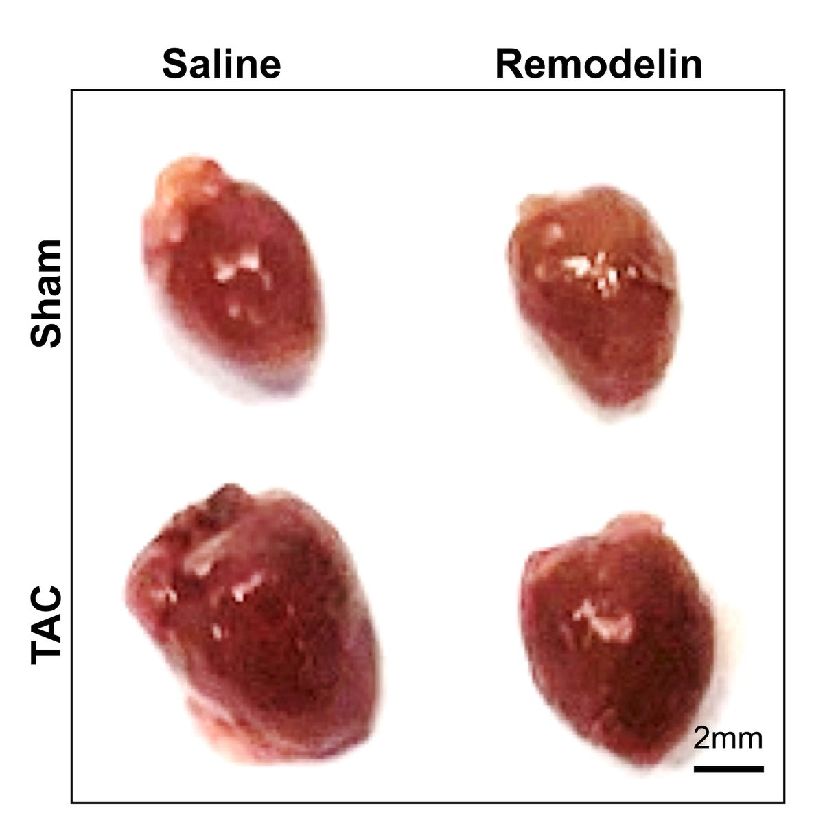 First time author <a href="/CircRes/">Circulation Research</a> Shi &amp; colleagues found modulating #epitranscriptomic processes, such as #ac4C acetylations through #NAT10, may be a promising therapeutic strategy against #CardiacRemodeling. Learn more at ahajournals.org/doi/10.1161/CI…

<a href="/LianminChen/">Lianmin Chen</a>