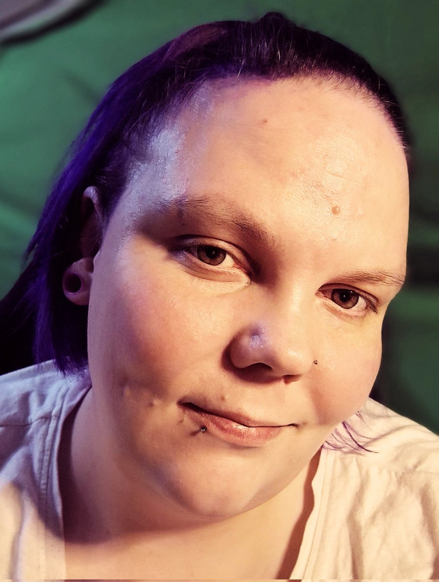 xFeuerkind's tweet photo. Es ist schön wenn der Schmerz nachlässt und die Nervenbahnen endlich Ruhe geben. So gibt's seit langem doch mal wieder ein #Montagslächeln 💜
#MEcfs #postcov #crps https://t.co/YhrHqv9rba