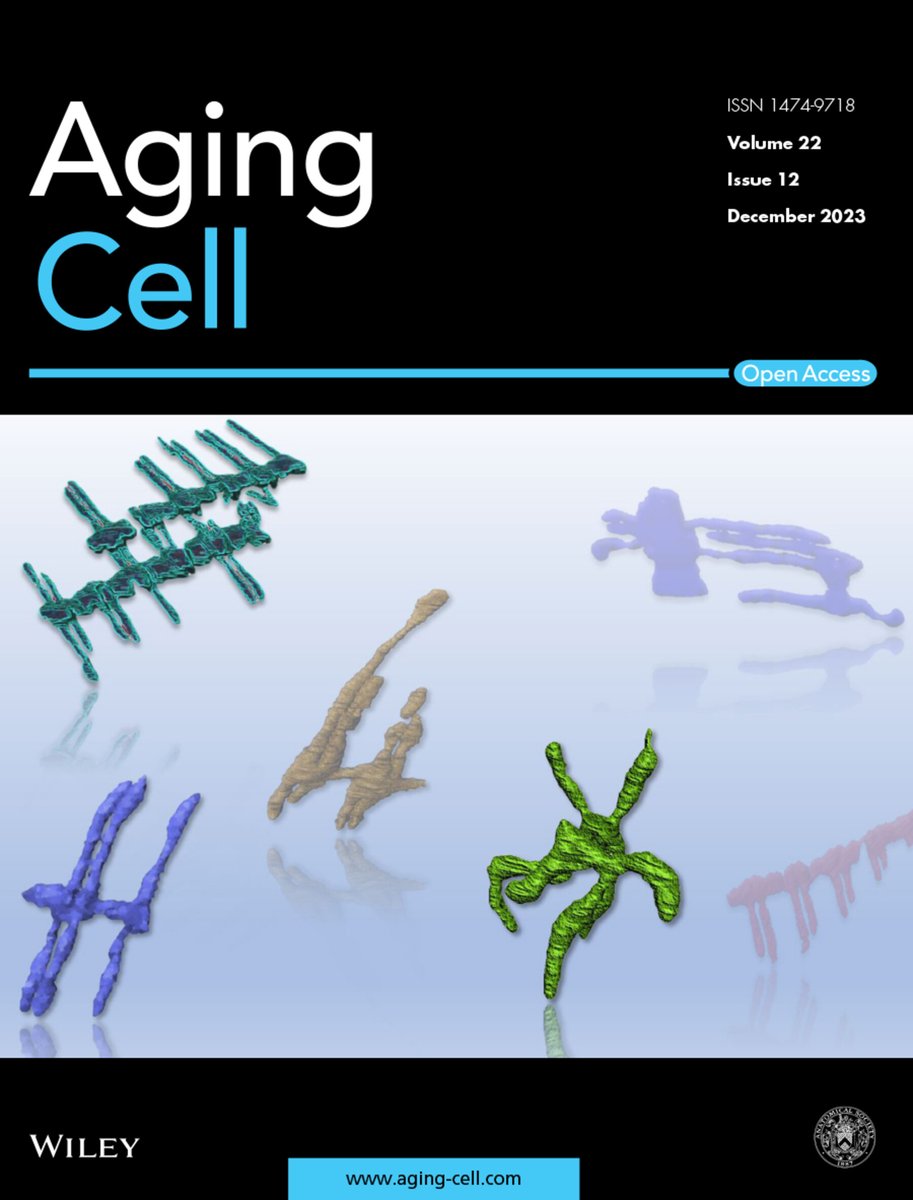 Antentor Othrell Hinton, Jr PhD (A.J. Hinton) (@phdgprotein86) on Twitter photo We got the cover of <a href="/Aging_Cell/">Aging_Cell</a>! Congrats <a href="/AtHinton/">Hinton Laboratory at Vanderbilt</a> <a href="/mcreynolds_lab/">The McReynolds Lab!</a> on the <a href="/WileyGlobal/">Wiley</a> <a href="/Aging_Cell/">Aging_Cell</a>
! TU co-first <a href="/ZerVue/">Zer Vue</a> <a href="/EdgarGa47227368/">Edgar Garza</a>
<a href="/NeikirkKit/">Kit Neikirk</a> <a href="/KattiiPrasanna/">Prasanna Katti</a> for your hard work! TU <a href="/dr_ohsopretty/">Dr. Melanie McReynolds</a> for your leadership! <a href="/VUBasicSciences/">Vanderbilt School of Medicine Basic Sciences</a> <a href="/BMB_PSU/">Penn State BMB</a> <a href="/VanderbiltU/">Vanderbilt University</a>
<a href="/penn_state/">Penn State</a> We got the cover of <a href="/Aging_Cell/">Aging_Cell</a>! Congrats <a href="/AtHinton/">Hinton Laboratory at Vanderbilt</a> <a href="/mcreynolds_lab/">The McReynolds Lab!</a> on the <a href="/WileyGlobal/">Wiley</a> <a href="/Aging_Cell/">Aging_Cell</a>
! TU co-first <a href="/ZerVue/">Zer Vue</a> <a href="/EdgarGa47227368/">Edgar Garza</a>
<a href="/NeikirkKit/">Kit Neikirk</a> <a href="/KattiiPrasanna/">Prasanna Katti</a> for your hard work! TU <a href="/dr_ohsopretty/">Dr. Melanie McReynolds</a> for your leadership! <a href="/VUBasicSciences/">Vanderbilt School of Medicine Basic Sciences</a> <a href="/BMB_PSU/">Penn State BMB</a> <a href="/VanderbiltU/">Vanderbilt University</a>
<a href="/penn_state/">Penn State</a>