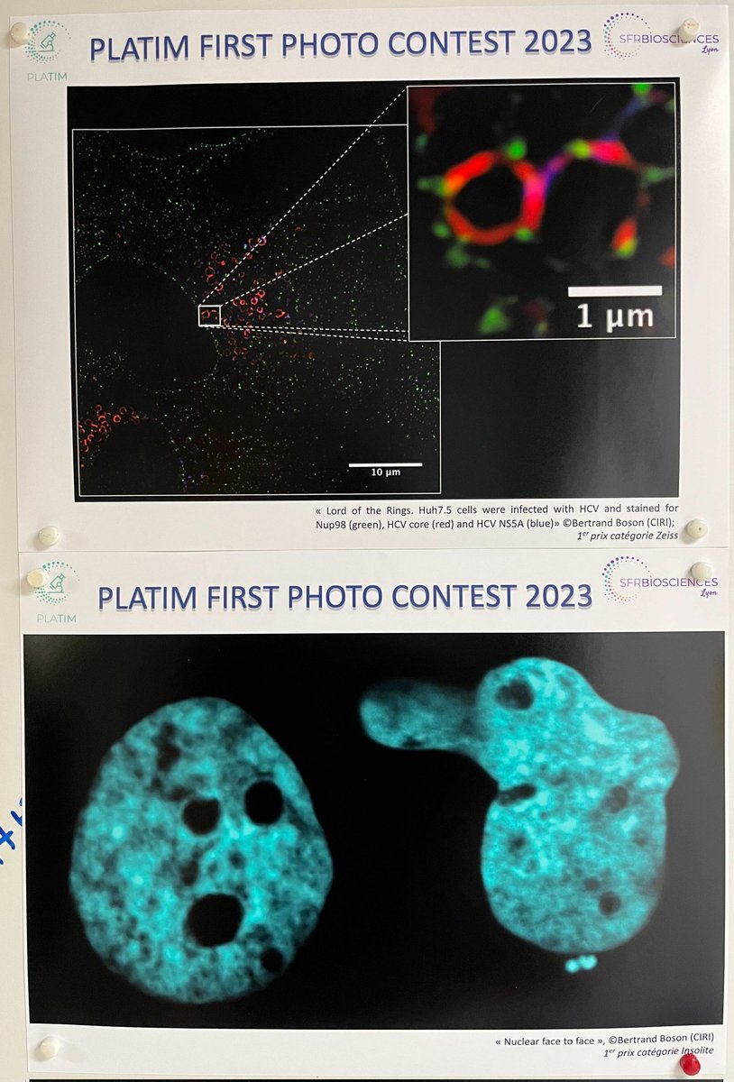 Funny science can make you win prizes! Thanks to <a href="/UMSBiosciences/">UAR Biosciences 3444</a> for supporting microscopy. <a href="/EvirTeam/">FL Cosset's lab</a>