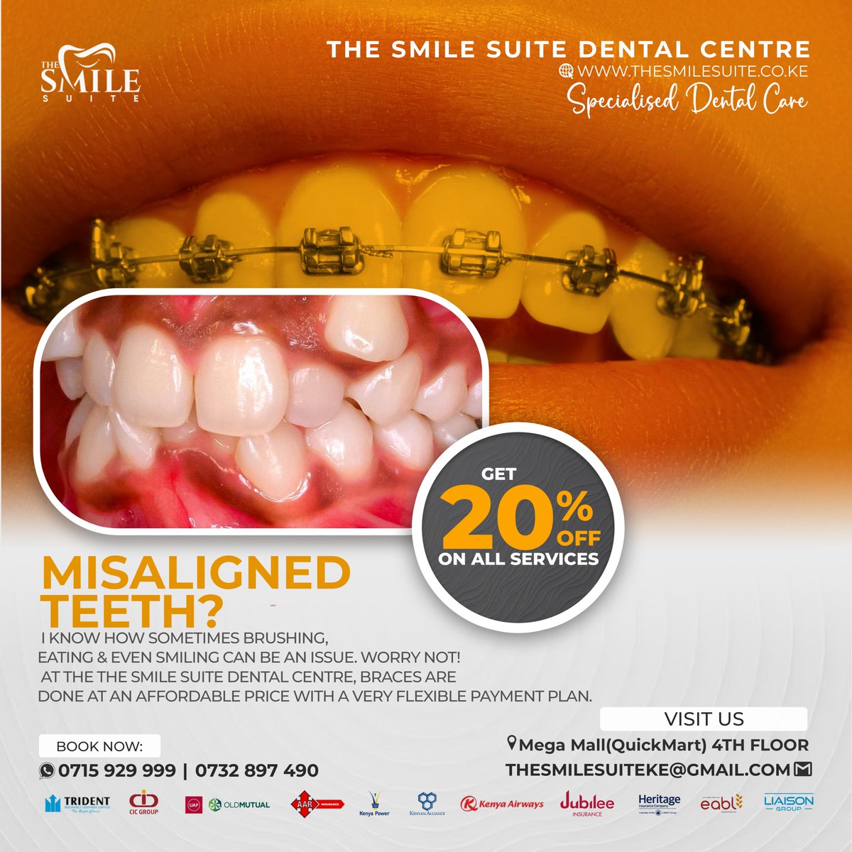 TheSmileSuite23's tweet image. Braces &amp;amp; teeth alignment at The Smile SUITE Dental Centre is done by one of the 12 Board Certified Orthodontists in the Country!
Experience quality care &amp;amp; results this holiday.
Location; 4th Floor, Mega Mall (QUICKMART), Kakamega
0715 929999
#braces #teethalignment #braceyourself