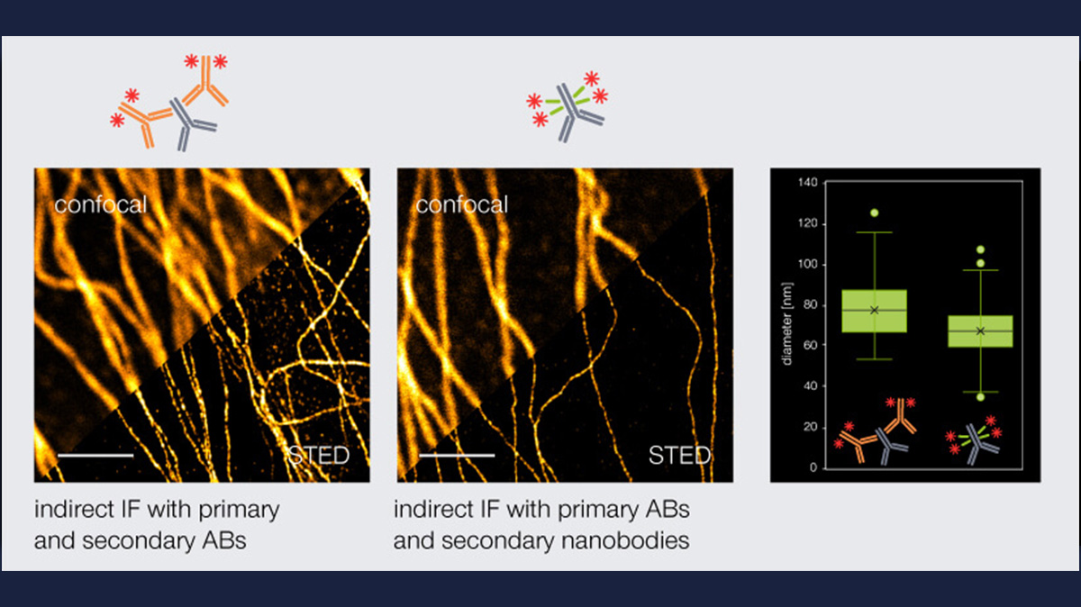 Unveiling precision in the nanoworld! With polyclonal secondary nanobodies, the linkage error is reduced while a strong fluorescence signal is maintained. Explore #confocal and #STED images with primary mouse anti-tubulin antibodies (AB) targeted by either secondary anti-mouse