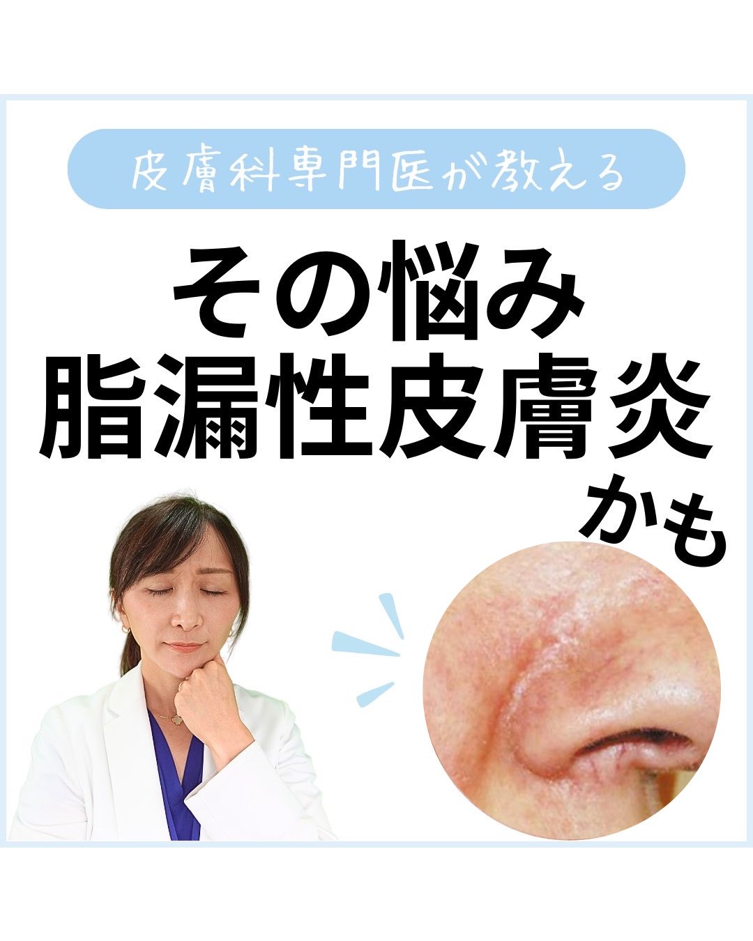 小林智子【皮膚科医】 on X: 