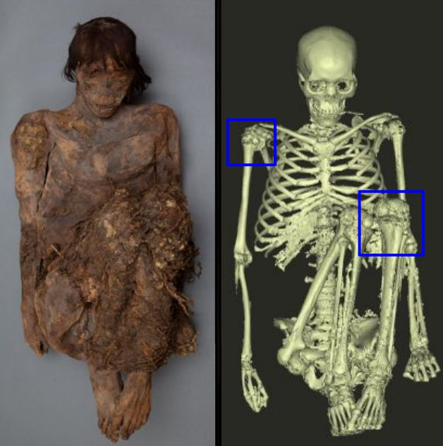 Desbloqueando la historia: Revelando la historia detrás de la momia cestera en Archival Revelation