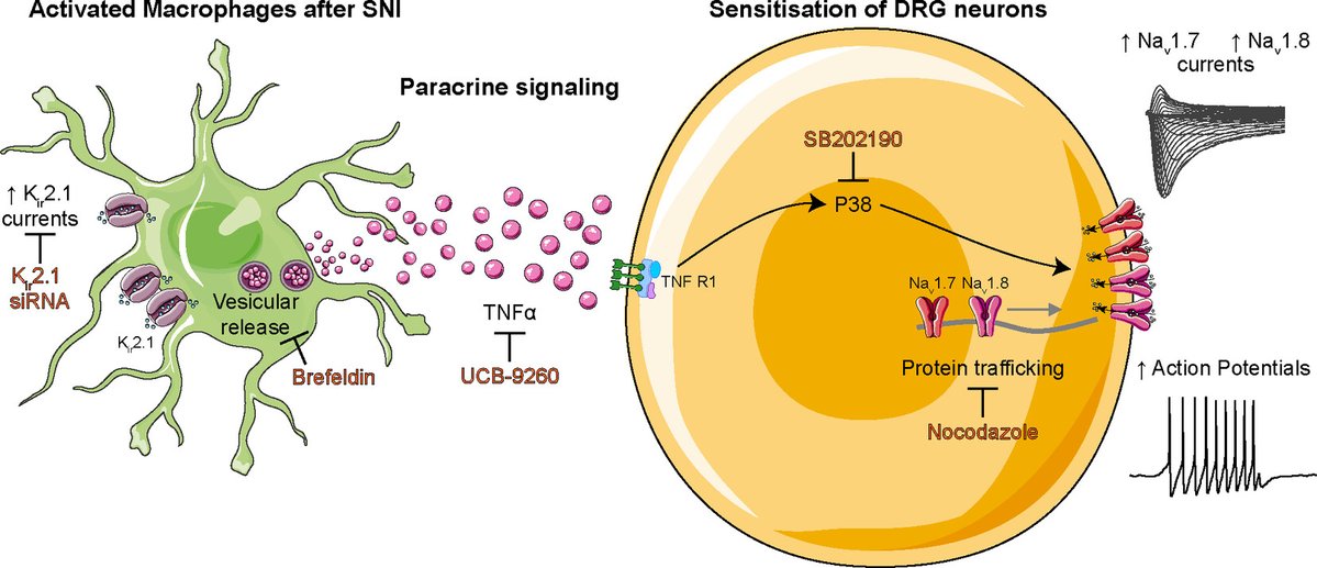 Our paper on the mechanism of sensitisation of primary sensory neurons by DRG macrophages after nerve injury is out in <a href="/GLIA_Journal/">GLIA</a> <a href="/WileyNeuro/">Wiley Neuro</a> !
onlinelibrary.wiley.com/doi/10.1002/gl…