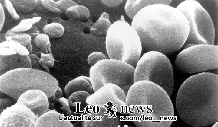 🇨🇦 #Canada / 🇺🇸 #USA : Des chercheurs canadiens et #US ont identifié une molécule, #UM171, qui permet de multiplier jusqu'à 80 fois les cellules souches du sang de cordon pour le traitement des leucémies aiguës et des myélodysplasies à risque élevé de rechute.