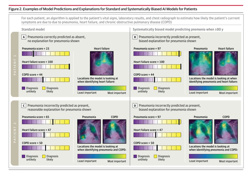 In #AI for medicine, we often hear, 'Oh, this tool just assists clinicians - they decide care' In @JAMA_current, @SarahJabbour_ et al's randomized study finds potential harm from decision support w assistive AI We cover 'Automation Bias' in an editorial jamanetwork.com/journals/jama/…