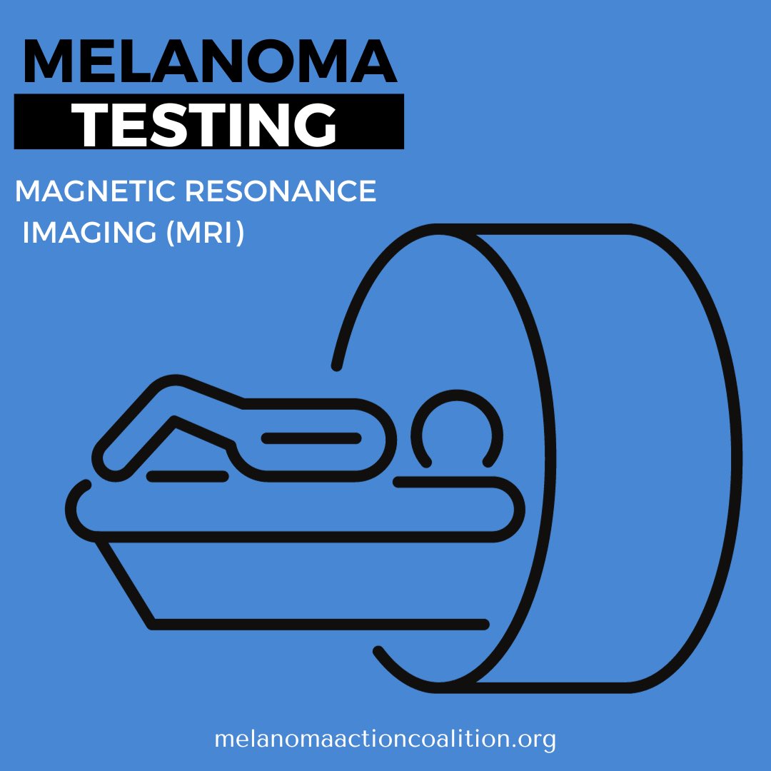 You might have an MRI scan to find out whether your melanoma has spread to anywhere else in your body. MRI uses magnetism and radio waves to create cross sectional pictures of the body. It produces pictures from angles all around the body and shows up soft tissues very clearly.