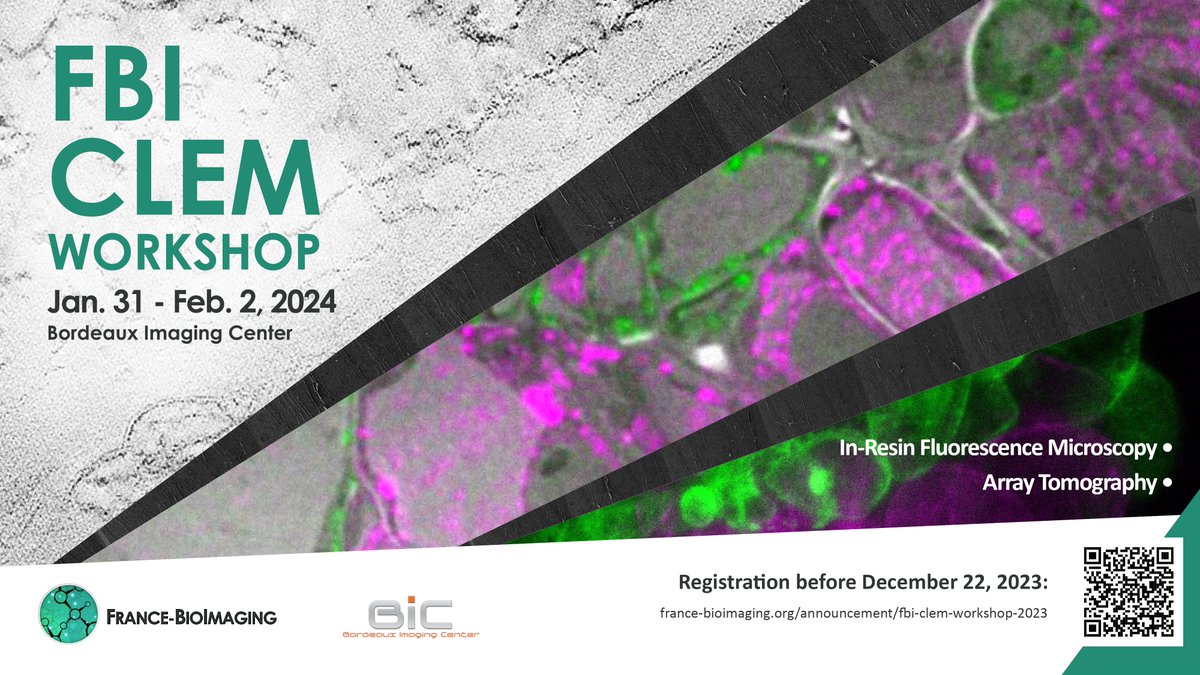 📢Learn the benefits of combining light &amp; electron imaging! We are organizing a workshop where participants can choose one of 2 CLEM practicals: In-resin fluorescence &amp; Array Tomography🔬
📆Bordeaux Imaging Center <a href="/BIC_Bordeaux/">BIC</a>
📍Jan. 31 - Feb. 2, 2024
france-bioimaging.org/fbi-special-ev…