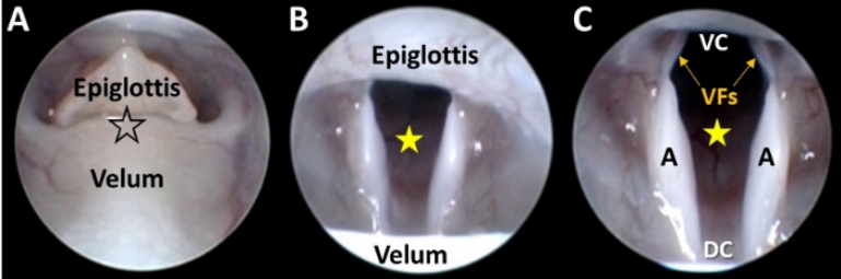 MizzouENT's tweet photo. How do you perform a direct #laryngoscopy and swallow evaluation on a rat? Dr. Lever et al has devised a protocol using a surgical human #otoscope! Now you can practice doing your micro-microflaps.

https://t.co/BwzlAonnm0

#ENTSurgery #laryngology #voice #swallow #otolaryngology https://t.co/C6NTH9uFf0