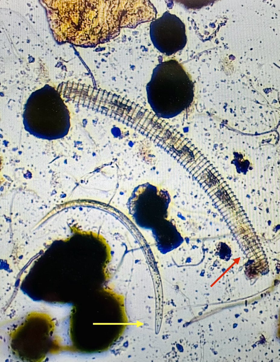 Looks can be deceiving: while the ring #nematode (red arrow) appears much more menacing than the root-knot nematode (yellow arrow), which is considered the most economically important plant-parasitic nematode worldwide? Winner: root-knot! 🏆🪱 @activeplantnema @SON_nemaweb