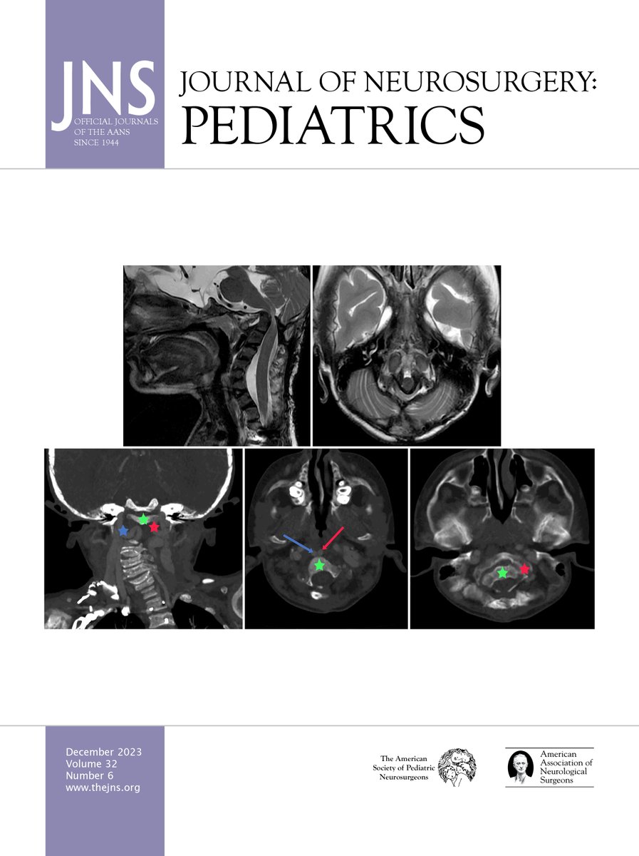 Congrats to some of our faculty, residents, and med students on landing their figure on the cover of @TheJNS Pediatrics earlier this month Neurosurgery's dedication to research is unmatched! Check out the full article at: bit.ly/41uSXDS