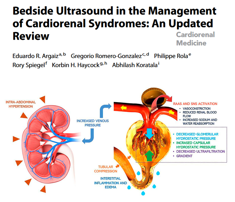 Final typeset version of the #POCUS in #Cardiorenal syndromes article is now available. 🔗karger.com/crm/article/13… #FOAMed #Nephpearls #MedEd