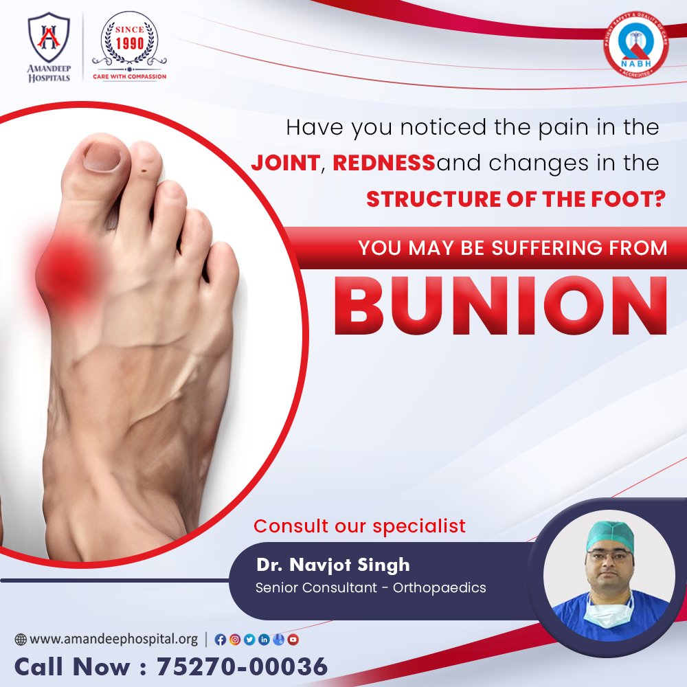 🩹 Pain, redness, or changes in your foot structure? It could be a bunion. Don't ignore!

👨‍⚕️ Consult Dr. Navjot Singh at Amandeep Hospital 

#BunionCare #ExpertConsultation #AmandeepHospital #Podiatry #Orthopedics #Healthcare #FootWellness #PainRelief #FootHealth #MedicalExperts