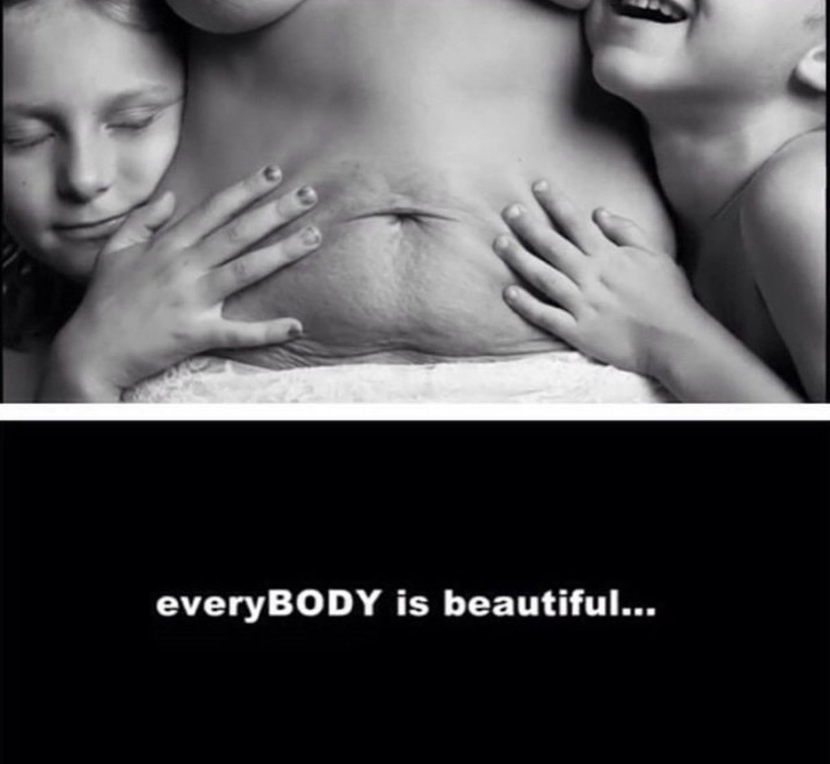 Every body is literally different and unique and inherently perfect in its shape and beauty. Every body is indeed beautiful.

#bodybeautiful #genz #healthyliving #healthyyou #bodyshaming #body #beauty