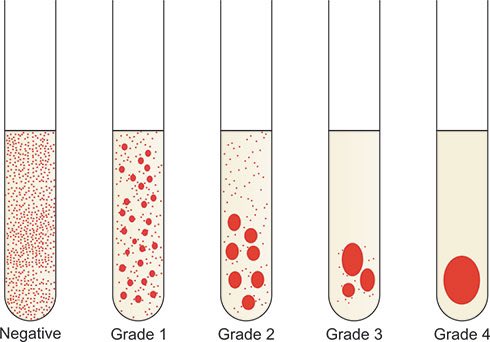 🧸🍉, RMT, MLS (ASCPi) 🔜 tweet media