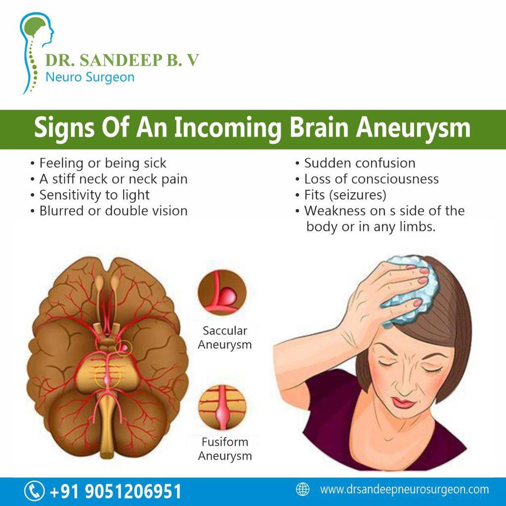 Signs of an incoming brain aneurysm 

Get treated at right time

Best brain aneurysm treatment in banglore 

#drsandeep #Neurology #Neurologist #brain #BrainHealth #damage #hemorrhagicstroke #death #brainaneurysms #endovascularcoiling #braindamage #newcells 
#BrainInjury