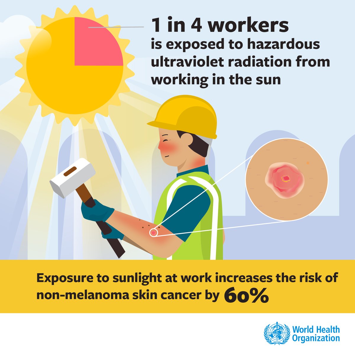 1.6 billion adults are exposed to potentially deadly solar #UVradiation ☀️ while working outdoors. This increases their risk of non-melanoma skin #cancer 👉bit.ly/464ojlt