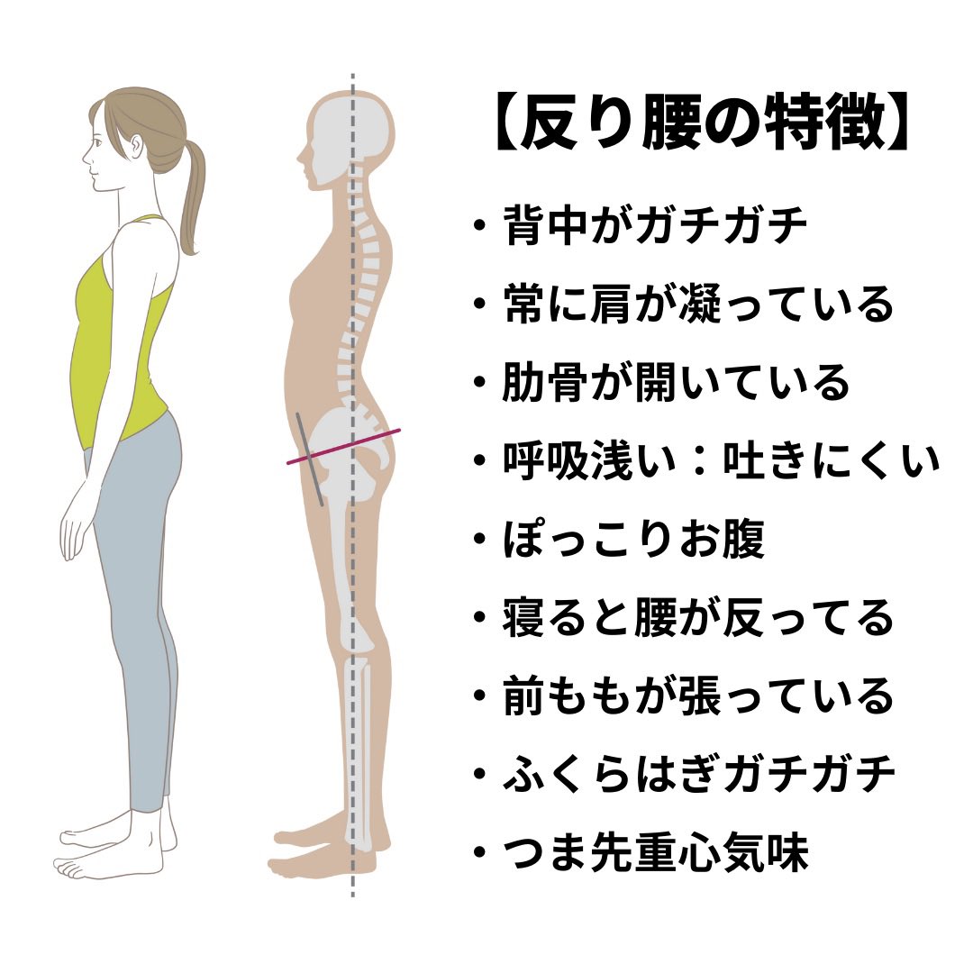 ogitoreshota's tweet photo. 反り腰さんは背中がガチガチに硬くなり、肋骨の開きやぽっこりお腹、前もも張りに繋がってしまう。

お腹を鍛えることは大切だけど、その前にガチガチに硬い背中をストレッチすることから！

背中のストレッチだけでも反り腰や肋骨の開き、肩こりも改善していきます！当てはまる方はこちら↓ https://t.co/uQPGUnrd7D