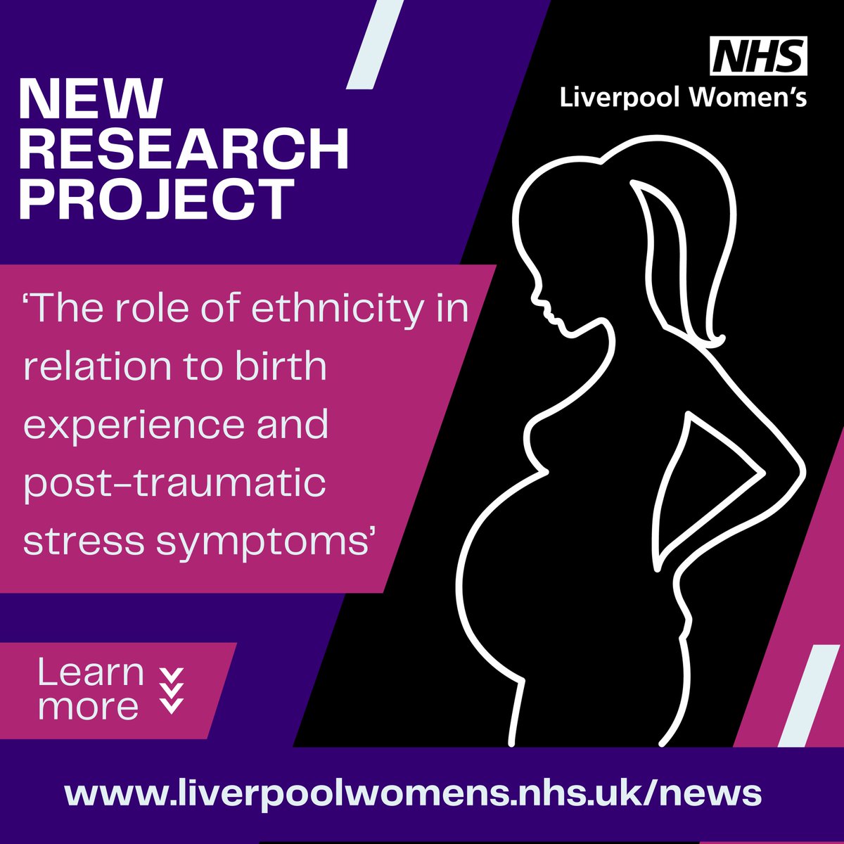 New Research Study - 'The role of ethnicity in relation to birth experience and post-traumatic stress symptoms’ For more information, follow the link on the poster and to sign up click the below: orlo.uk/NRre1