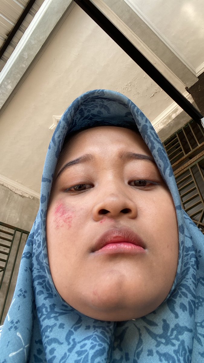 nfchtss's tweet photo. Rasanya kek udah mati rasa dengan yang namanya sakit, kemarin sakit types sekitar seminggu, belum aja sembuh udah gini aja huhuhu…. https://t.co/MOEhPrzTvY