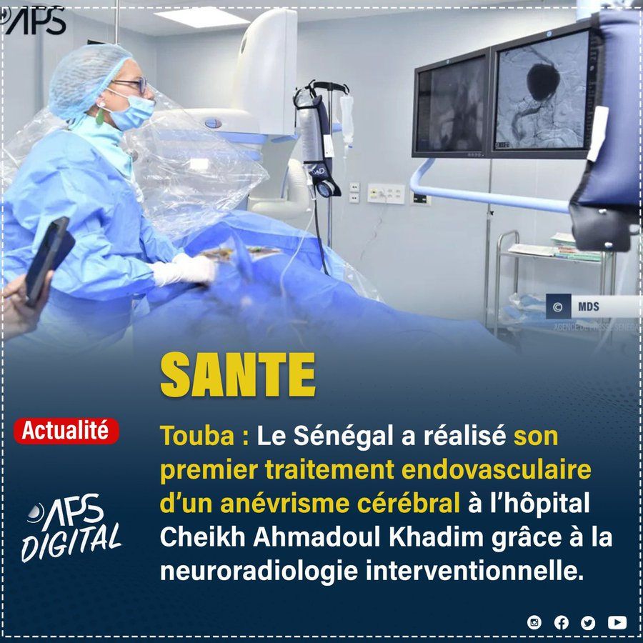 #Touba : Le Sénégal a réalisé son premier traitement endovasculaire d’un anévrisme cérébral à l’hôpital Cheikh Ahmadoul Khadim grâce à la neuroradiologie interventionnelle.
#Senegal