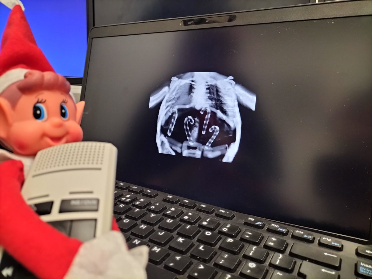 Ray is keen to learn more so has been helping our Radiologists this morning by reporting some X-rays ...
Definitely a case of too many candy canes for this patient!