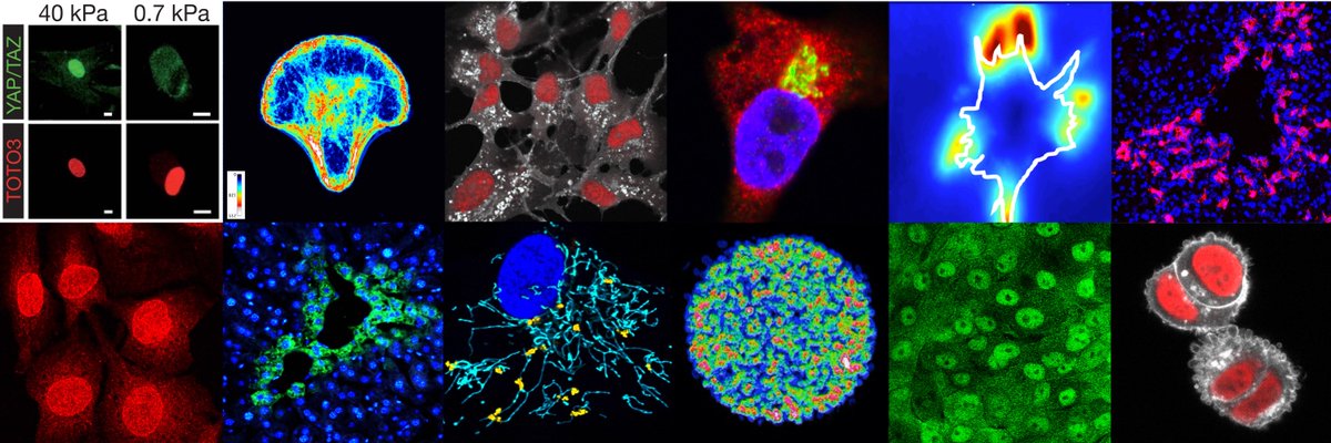 Sirio Dupont (@siriodupont) on Twitter photo ⏰WE ARE HIRING
3+y postdoctoral positions in the context of a major <a href="/AIRC_it/">Fondazione AIRC per la ricerca sul cancro</a> grant 🎉
we will pursue our studies on mitochondrial mechanotransduction in breast cancer metastasis, including new mouse models & new drugs in the pipeline
Please RT and DM if you are interested ⏰WE ARE HIRING
3+y postdoctoral positions in the context of a major <a href="/AIRC_it/">Fondazione AIRC per la ricerca sul cancro</a> grant 🎉
we will pursue our studies on mitochondrial mechanotransduction in breast cancer metastasis, including new mouse models & new drugs in the pipeline
Please RT and DM if you are interested