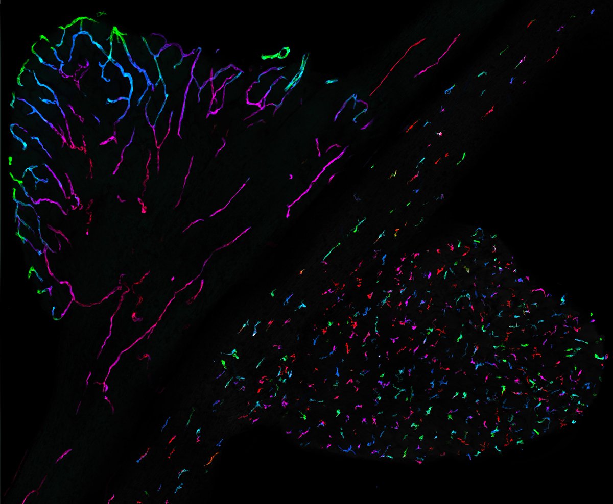 Blood-nerve barrier discovery in the peripheral nervous system has implications for disease targeting and treatment. New study published in <a href="/JExpMed/">Journal of Experimental Medicine</a>. Research by <a href="/o_harald/">Harald Lund</a>, <a href="/Science_Hunt/">Matt Hunt</a>, @justZeri, <a href="/PainLab_KI/">Camilla Svensson</a> et al.