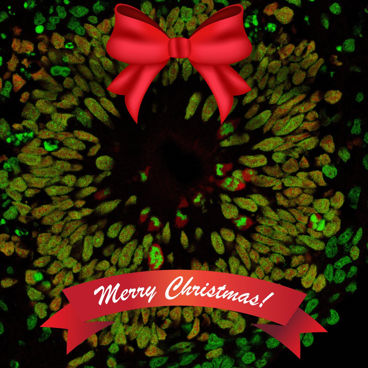 Andrea Brand (@andreabrandlab) on Twitter photo Merry Christmas and a Happy New Year from the Brand Lab! Festive organoid picture by <a href="/lauraygherghina/">Laura-Yvonne Gherghina</a> Merry Christmas and a Happy New Year from the Brand Lab! Festive organoid picture by <a href="/lauraygherghina/">Laura-Yvonne Gherghina</a>