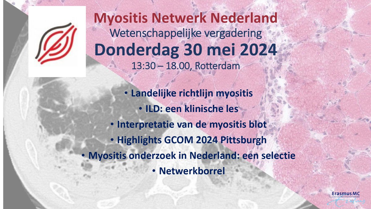 DutchMyositis's tweet image. 🚨 SAVE THE DATE 🚨
Geïnteresseerd in #myositis onderzoek? 

✍️ Wees dan ook bij de wetenschappelijke vergadering van #MyositisNetwerkNederland op do 30 mei 2024 13.30-18.00 in Rotterdam!

🥂 Hopelijk tot dan en deel ons bericht vooral ook met andere (mogelijk) geïnteresseerden!