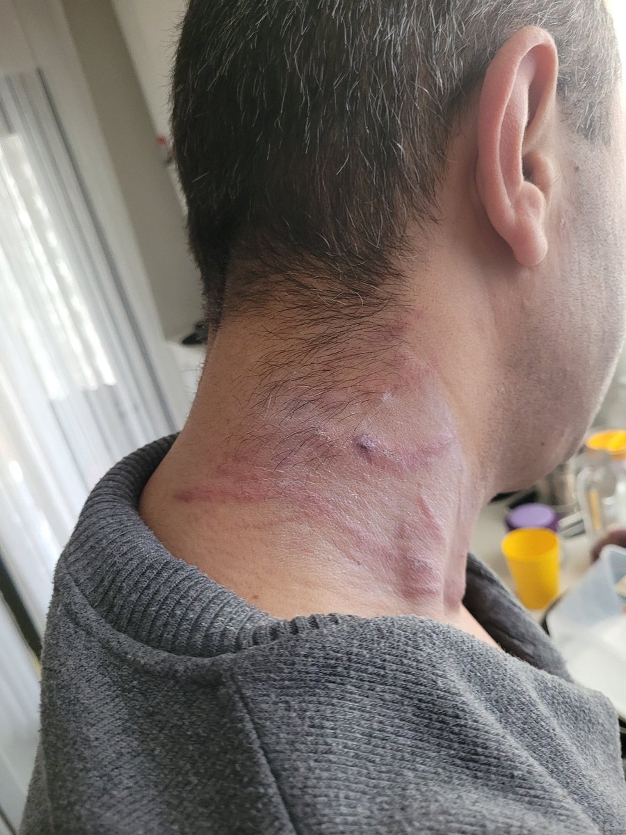 Yılbaşı gecesi görevini yaparken Sultanbeyli/Esenler mahallesinde aile içi şiddet anonsuna giden meslektaşlarımız aile tarafından darp edilmiş… 

Öyle bir darp ki taşlarla, sopalarla ekip otosunu dahi kullanılamaz hale getirmişler. 
Sırtlarına, kafalarına sopalarla darbe alan,