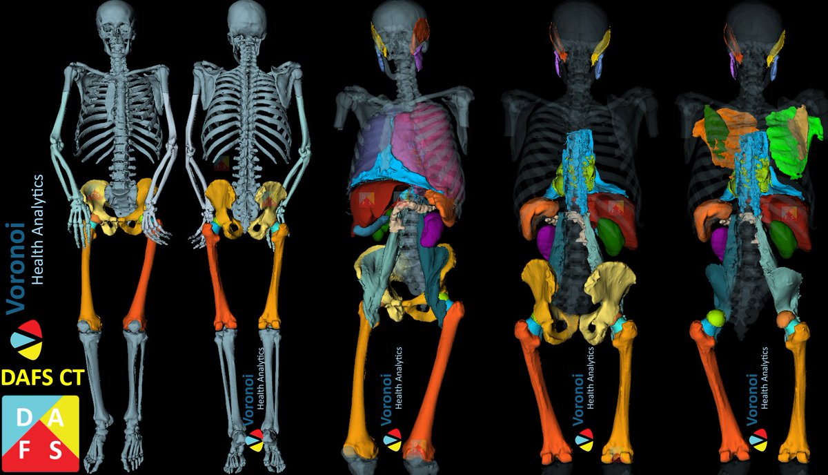 Voronoi Health Analytics Inc. tweet media
