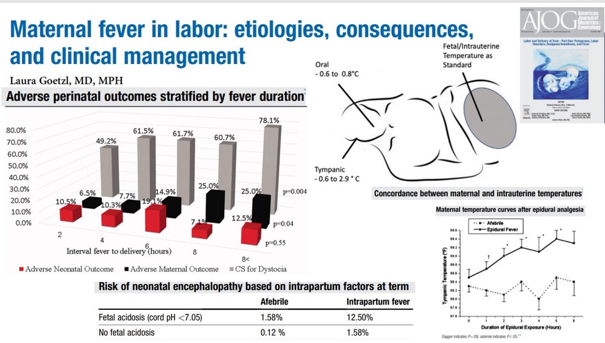 #ObstetriciaSEDAR 🤰🏻La fiebre intraparto generalmente tiene un origen inflamatorio no infeccioso. Controlarla es importante, pues reduce la contractilidad uterina, aumenta el riesgo de cesárea o de hemorragia postparto ♀️ No te pierdas esta revisión❤️ pubmed.ncbi.nlm.nih.gov/36997396/