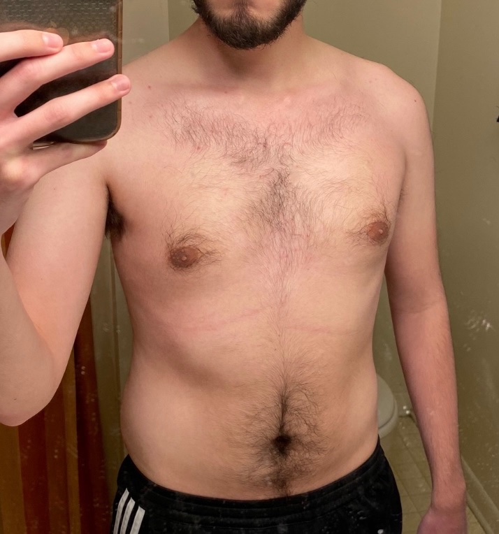NateInflate's tweet photo. Starting off 2024 with 50 pounds gained 🐻 https://t.co/iz3SsYGbbq